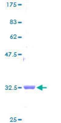 SDS-PAGE Recombinant Human NDUFB1 GST (N-Term) Protein