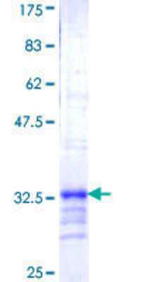 12.5% SDS-PAGE Stained with Coomassie Blue.