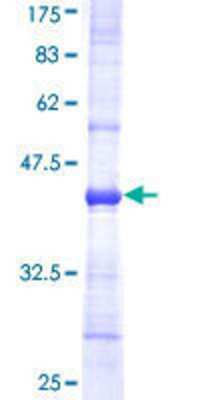 SDS-Page: Recombinant Human NDUFB5 Protein [H00004711-Q01] - 12.5% SDS-PAGE Stained with Coomassie Blue.