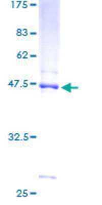 SDS-PAGE Recombinant Human NDUFB8 GST (N-Term) Protein