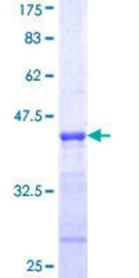 SDS-Page: Recombinant Human NDUFB10 Protein [H00004716-Q01] - 12.5% SDS-PAGE Stained with Coomassie Blue.