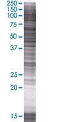 NDUFS6 transfected lysate.