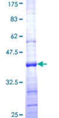SDS-Page: Recombinant Human NDUFS8 Protein [H00004728-Q01] - 12.5% SDS-PAGE Stained with Coomassie Blue.