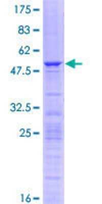Other Recombinant Human RPL10A GST (N-Term) Protein