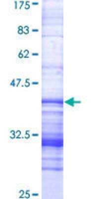 SDS-Page: Recombinant Human NEK1 Protein [H00004750-Q01] - 12.5% SDS-PAGE Stained with Coomassie Blue.