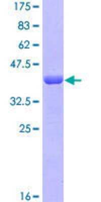 12.5% SDS-PAGE Stained with Coomassie Blue.