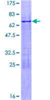 12.5% SDS-PAGE Stained with Coomassie Blue.