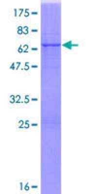 12.5% SDS-PAGE Stained with Coomassie Blue.