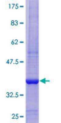 12.5% SDS-PAGE Stained with Coomassie Blue.