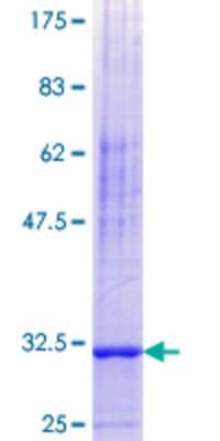 SDS-Page: Recombinant Human Neuronatin Protein [H00004826-Q01] - 12.5% SDS-PAGE Stained with Coomassie Blue.