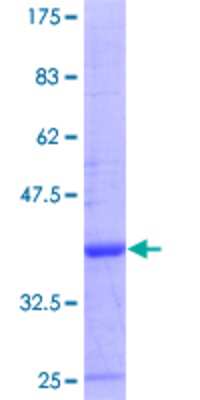 SDS-Page: Recombinant Human CNOT4 Protein [H00004850-Q01] - 12.5% SDS-PAGE Stained with Coomassie Blue.