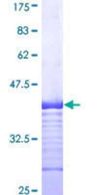 SDS-Page: Recombinant Human NRAMP2/SLC11A2/DMT1 Protein [H00004891-Q01] - 12.5% SDS-PAGE Stained with Coomassie Blue.