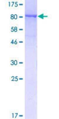 SDS-Page: Recombinant Human NUP98 Protein [H00004928-P01] - 12.5% SDS-PAGE Stained with Coomassie Blue.