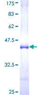 SDS-Page: Recombinant Human NUP98 Protein [H00004928-Q01] - 12.5% SDS-PAGE Stained with Coomassie Blue.