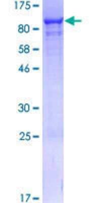 Other Recombinant Human NVL GST (N-Term) Protein