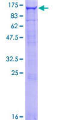 SDS-Page: Recombinant Human OCRL Protein [H00004952-P01] - 12.5% SDS-PAGE Stained with Coomassie Blue.