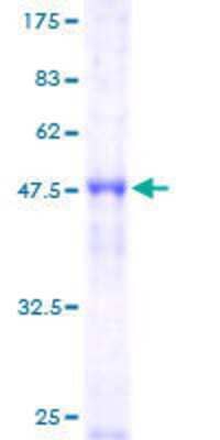 12.5% SDS-PAGE Stained with Coomassie Blue.