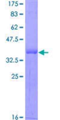 SDS-Page: Recombinant Human Otx1 Protein [H00005013-Q01] - 12.5% SDS-PAGE Stained with Coomassie Blue.