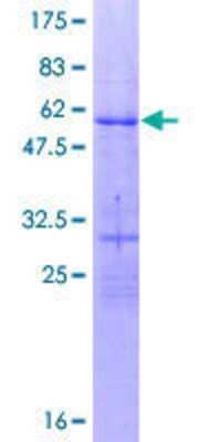 SDS-Page: Recombinant Human OVOL1 Protein [H00005017-P02] - 12.5% SDS-PAGE Stained with Coomassie Blue.