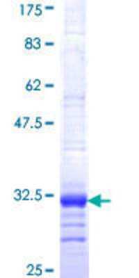 SDS-PAGE Recombinant Human P2Y1/P2RY1 GST (N-Term) Protein