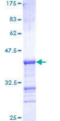 SDS-Page: Recombinant Human PAK1 Protein [H00005058-Q01] - 12.5% SDS-PAGE Stained with Coomassie Blue.