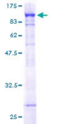 Recombinant Human PARN Protein [H00005073-P01] - 12.5% SDS-PAGE Stained with Coomassie Blue.