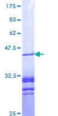 Other Recombinant Human PAWR / PAR4 GST (N-Term) Protein