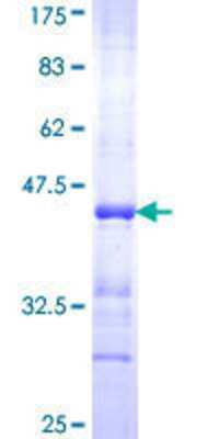 12.5% SDS-PAGE Stained with Coomassie Blue.