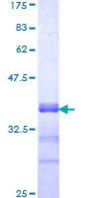 12.5% SDS-PAGE Stained with Coomassie Blue.