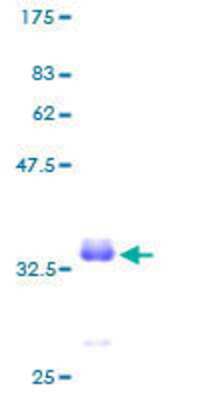 SDS-PAGE Recombinant Human PCP4 GST (N-Term) Protein