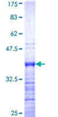 12.5% SDS-PAGE Stained with Coomassie Blue.