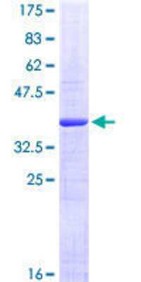 SDS-Page: Recombinant Human PDE6C Protein [H00005146-Q01] - 12.5% SDS-PAGE Stained with Coomassie Blue.