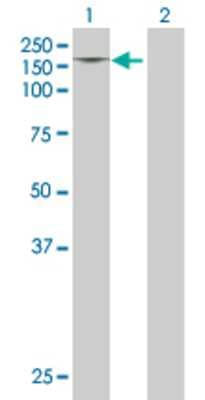 Lane 1: PDGFRA transfected lysate (122.7 KDa) Lane 2: Non-transfected lysate.