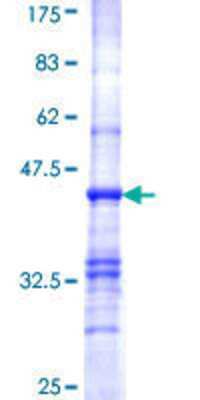 SDS-Page: Recombinant Human Pyruvate Dehydrogenase E1 beta subunit Protein [H00005162-Q01] - 12.5% SDS-PAGE Stained with Coomassie Blue.