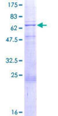 12.5% SDS-PAGE Stained with Coomassie Blue.