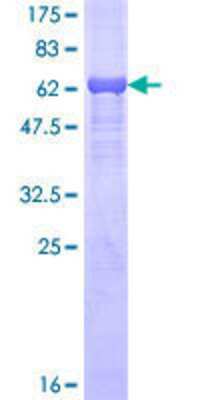 12.5% SDS-PAGE Stained with Coomassie Blue.