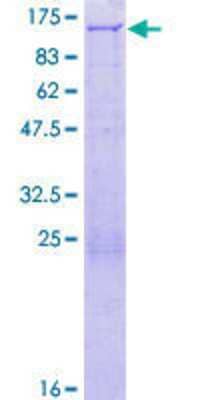 Other Recombinant Human PEX6 GST (N-Term) Protein