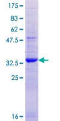 SDS-Page: Recombinant Human BRIC Protein [H00005205-Q01] - 12.5% SDS-PAGE Stained with Coomassie Blue.
