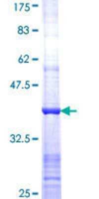 SDS-Page: Recombinant Human PFKL Protein [H00005211-Q01] - 12.5% SDS-PAGE Stained with Coomassie Blue.
