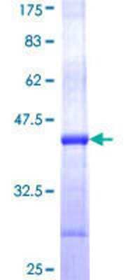 12.5% SDS-PAGE Stained with Coomassie Blue.