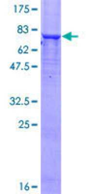 Other Recombinant Human Phosphoglucomutase 5 GST (N-Term) Protein