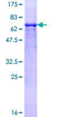 12.5% SDS-PAGE Stained with Coomassie Blue.