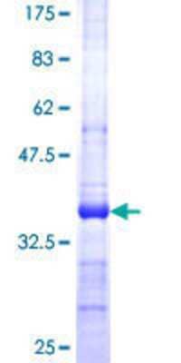 Other Recombinant Human SerpinB9 GST (N-Term) Protein