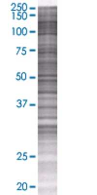 SERPINI2 transfected lysate.