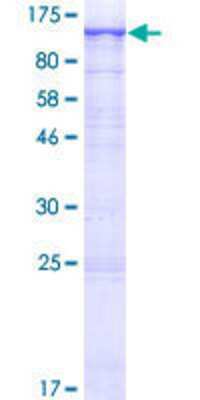 12.5% SDS-PAGE Stained with Coomassie Blue.