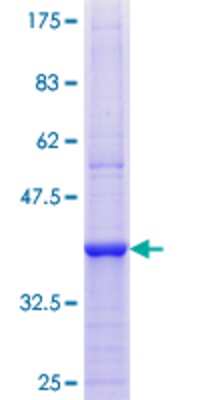 12.5% SDS-PAGE Stained with Coomassie Blue.