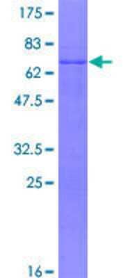 12.5% SDS-PAGE Stained with Coomassie Blue.