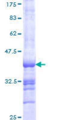 12.5% SDS-PAGE Stained with Coomassie Blue.