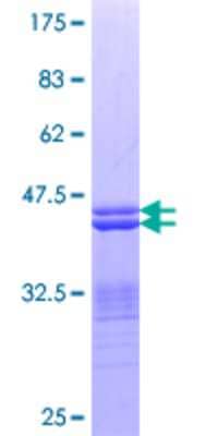 12.5% SDS-PAGE Stained with Coomassie Blue.