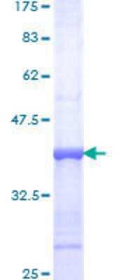 Unknown Recombinant Human Phospholipase C delta 1 GST (N-Term) Protein